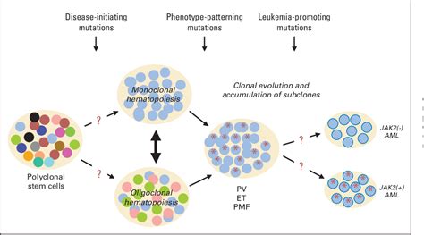 Figure 1 From Myeloproliferative Neoplasms Molecular Pathophysiology