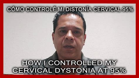 Testimonio C Mo Control Mi Diston A Cervical Testimony Of How I