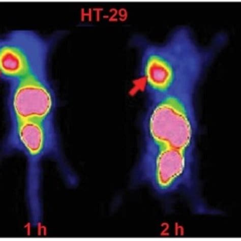 Static Planar Images Of Nude Mice Bearing HT 29 Colon Cancer Xenografts