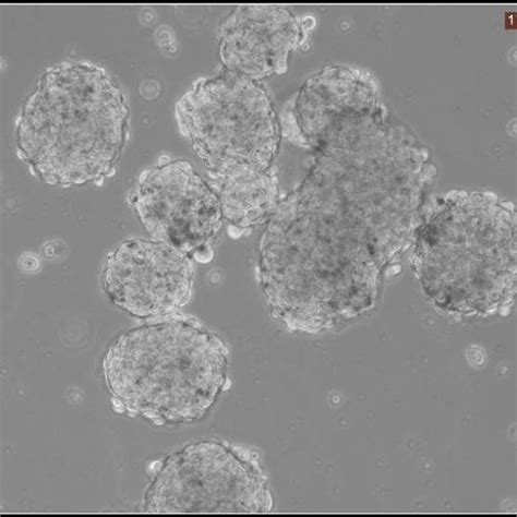 Sphere Formation Assay Aldh Cells Formed Spheres And The