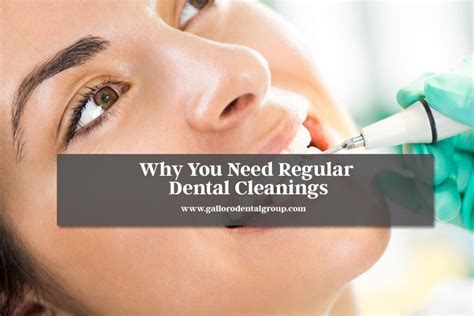 Why You Need Regular Dental Cleanings Galloro Dental Group