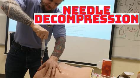 How To Perform Needle Decompression With Ars Gauge Inch