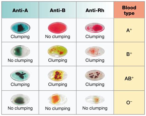 Blood Type A B O - Blood Type Info