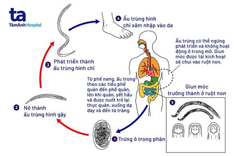 Giun móc là gì Đặc điểm hình thể ấu trùng phát triển thế nào