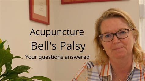 Acupuncture For Bells Palsy Faq Youtube