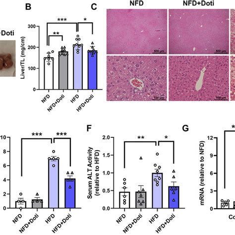 Effects Of Urat Selective Inhibitor Treatment On Hfd Induced Nafld