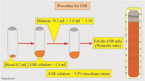 Erythrocyte Sedimentation Rate Esr Solution And Procedure