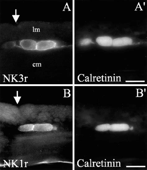 Ab′ Localisation Of Nk3r And Nk1r In The Same Nerve Cells In Serial