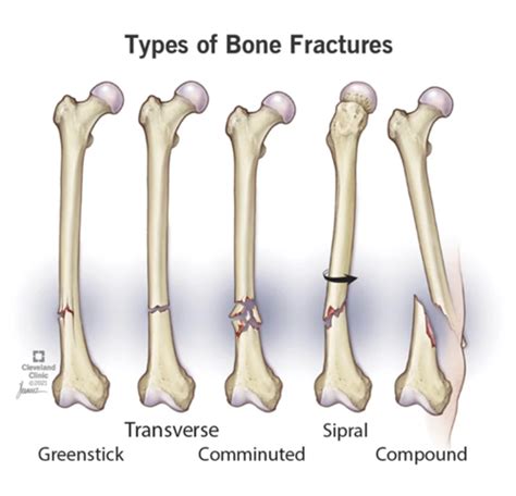 Chap Musculoskeletal Articular Dysfunction Flashcards Quizlet