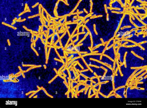 Legionella Lungs Hi Res Stock Photography And Images Alamy