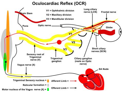 Vagal Reflex Bradycardia