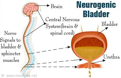 Neurogenic Bladder Causes Symptoms Diagnosis Treatment