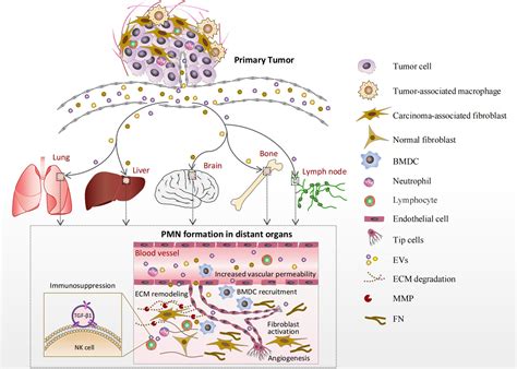 Frontiers Pre Metastatic Niche Formation In Different Organs Induced