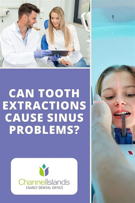 Bad Sinus Infection After Tooth Extraction