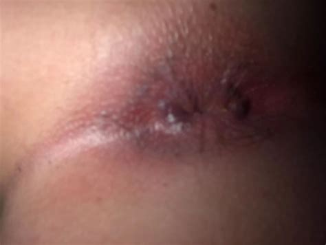 Will You Stick It In My Tight Asshole Nudes Assholeselfies Nude Pics Org