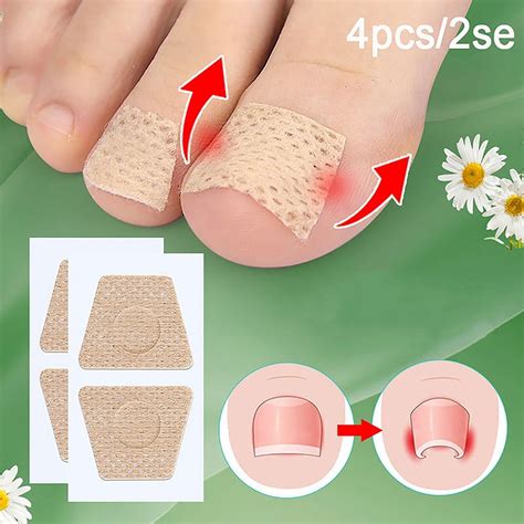 Ingrown Toenail Correction Anti Paronychia Treatment Toe Nail Sticker