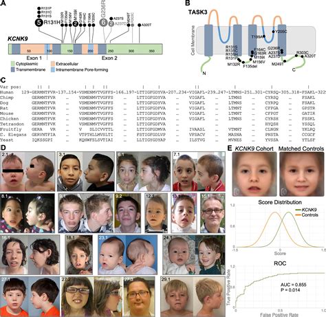 Scientists Unravel Mystery Of Rare Neurodevelopmental Disorder Provide