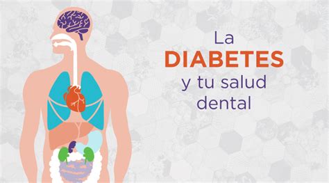 D A Mundial De La Diabetes Aprende Sobre El Cuidado Dental Para Los