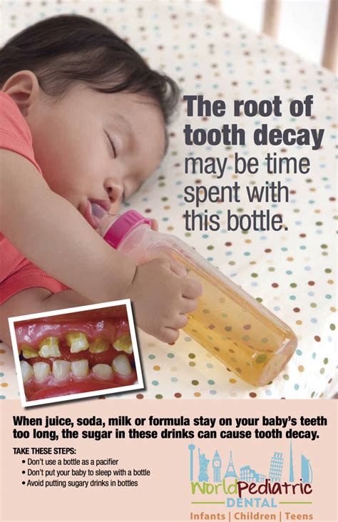 Baby Bottle Tooth Decay | Baby Dentist San Antonio, TX