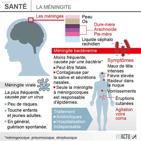 Cas mortels de méningite 7 questions pour mieux comprendre cette