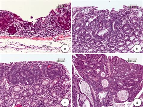 Colonic Lesions Induced By Aom And 2 Dss A A Mucosal Ulcer B Download Scientific Diagram