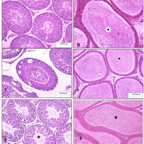 A Control Rat Testis Showing Multiple Cross Sections In Seminiferous