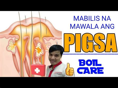 Pigsa Na Naman Gamot Publiko Magalang Pampanga Facebook 53 Off