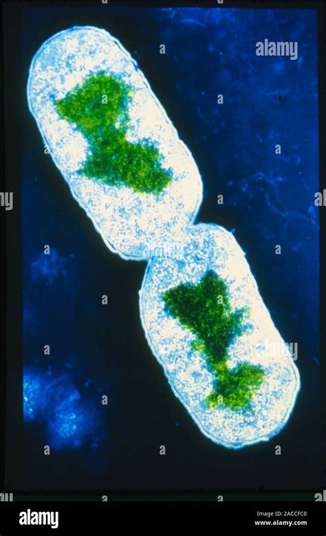 Falso Color micrografía de electrones de la transmisión de la bacteria