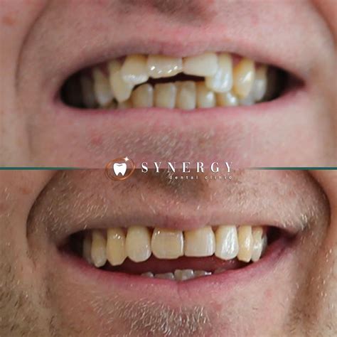 Dr Ali Altaf Synergy Preston Invisalign Synergy Dental Clinic