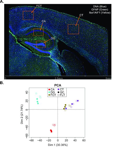 Dsp Of The Mouse Brain Under Spaceflight And Grounded Control