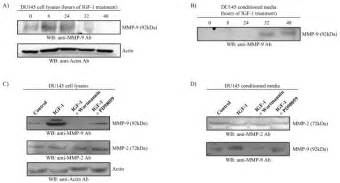 IGF 1 Regulates The Activity Of MMP 9 And MMP 2 By Different