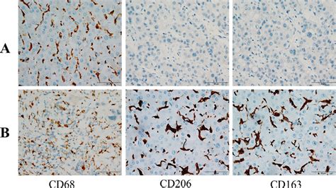 Immunohistochemical Staining Of Hcc Tissues A Normal Hepatic Tissues