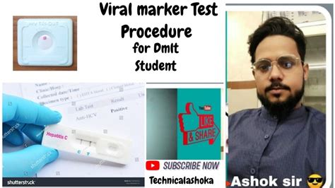 Viral Marker Test Procedure Lab Science Youtube