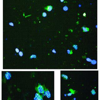 Representative TAT Images Both The DAPI Stained Nuclei Blue And The