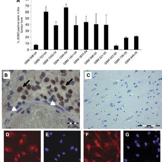 Immunohistochemistry Of Gbm Tissue And Primary Gbm Cells Tumour Cell