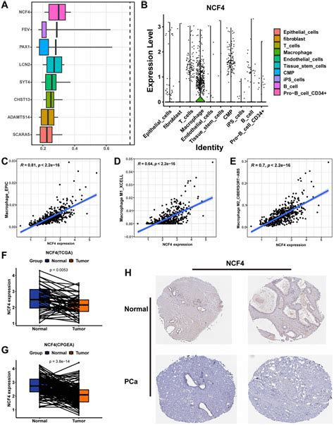 Comprehensive Analysis Of Macrophage Related Genes In Prostate Cancer