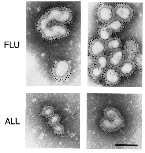 Flu Virus Under Microscope