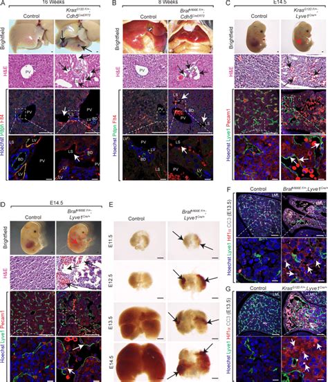 Endothelial KrasG12D Or BrafV600E Gain Of Function Mutations Cause