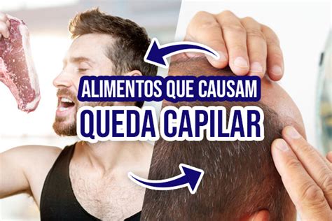 Alimentos E Subst Ncias Que Podem Causar Queda De Cabelo Minoxidil Br