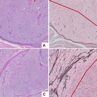 Representative histological features and reticular fibre staining of ...