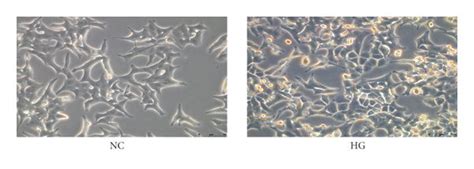 High Glucose Induced Pyroptosis In Ins 1 Cells A Ins 1 Cells Were Download Scientific