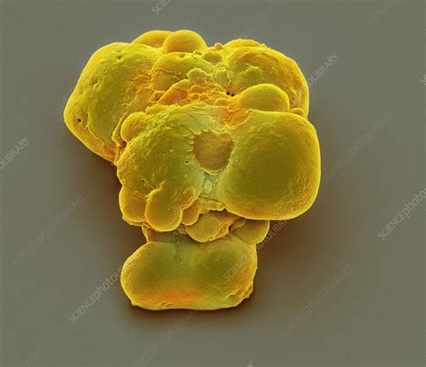 Pluripotent Stem Cells SEM Stock Image C023 0305 Science Photo