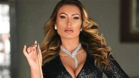 Andressa Urach Compartilha Foto Das Costelas Ap S Retir Las