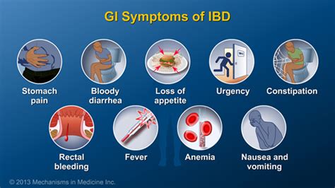 Diagnosing Ibd