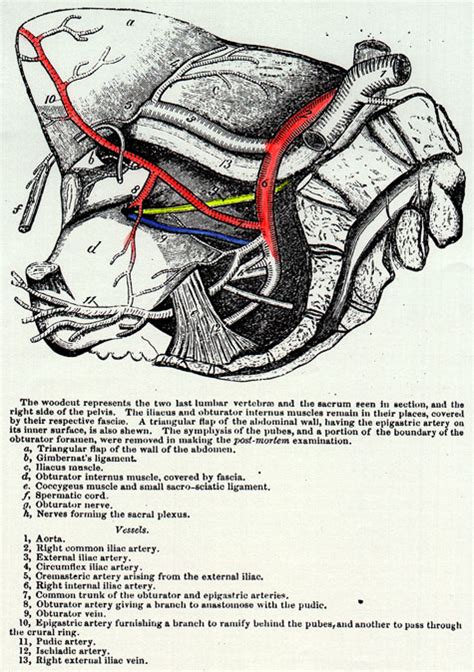 Image Of Common Trunk For Obturator And Epigastric Arteries