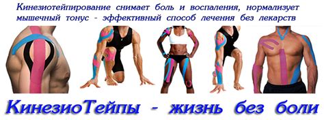 Физиотерапия