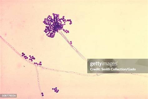 122 Aspergillus Under Microscope Stock Photos High Res Pictures And