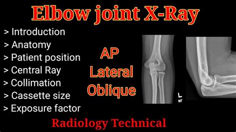 Elbow Joint X Ray Position Ap Lateral Oblique View By Bl