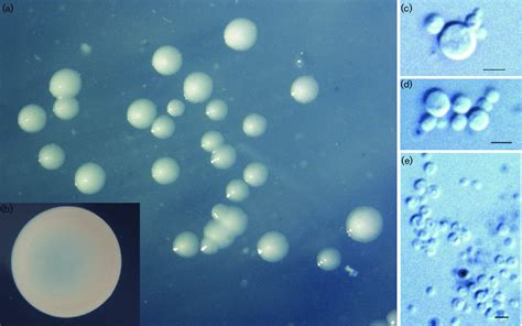 Morphological Characteristics Of Strain Fc18 T Colonies Grown In M13