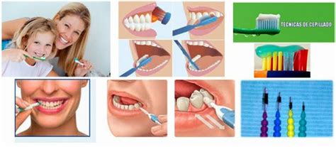 Tips De Salud Bucal El Correcto Cepillado De Tus Dientes